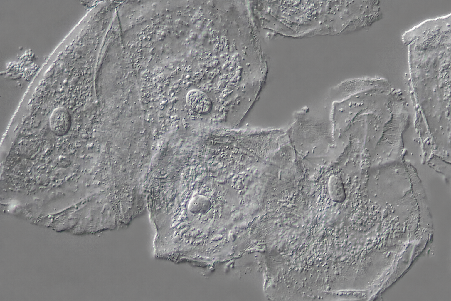 Это <a href="https://www.canadiannaturephotographer.com/diffential_interference_microscopy.html">клетки с внутренней поверхности щеки</a>, увеличение в 200 раз, качество прям офигенное для микроскопа
