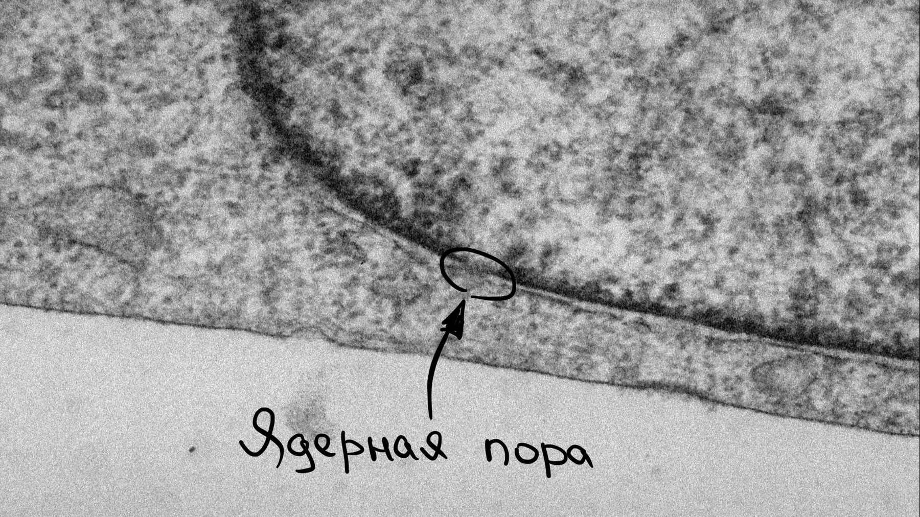 Для тех, кто шарит: на этой фотке видно, что у ядра 2 мембраны, а у самой клетки всего одна. А ещё в ядре есть ядерные поры: через них гены общаются со всей остальной клеткой